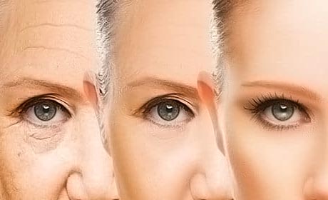 درمان چروک پوست و افتادگی پوست صورت